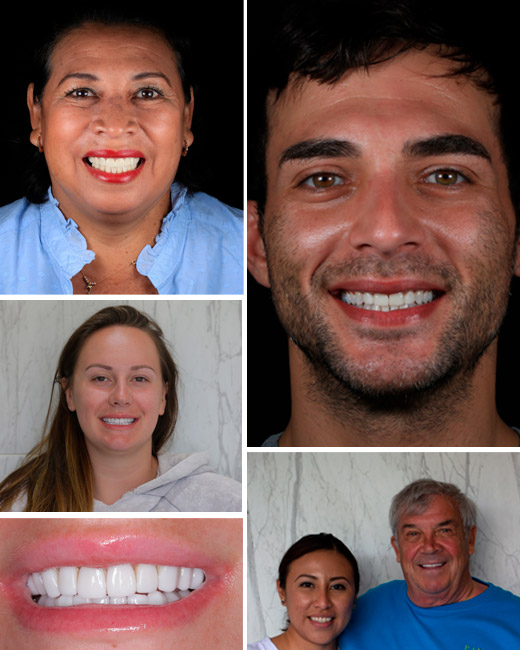 collage-patients-smile-makeover alt="Smile Makeover dental results patients"