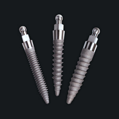 Mini Implants Smile Makeover