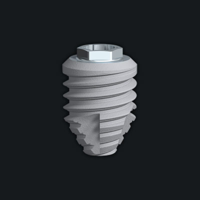 Short Dental Implants Smile Makeover