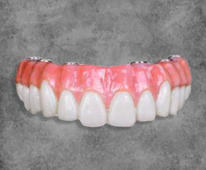 All on 4 Smile Makeover Mexico