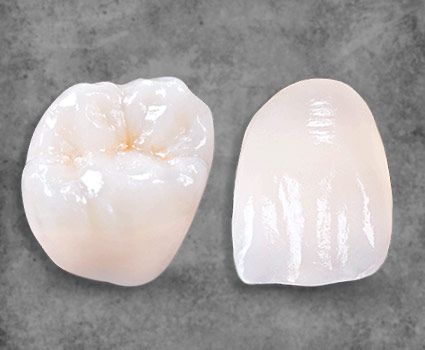 Crowns Mexico dental treatments