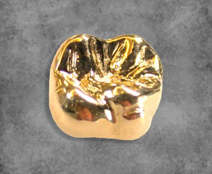 Mexico Dental work crowns