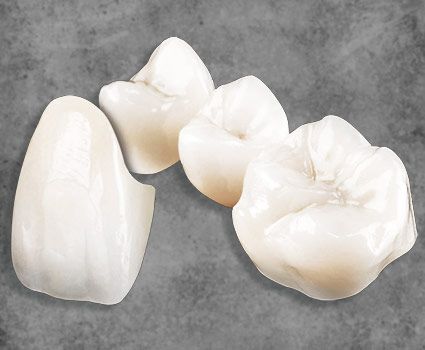 Dental crowns Mexico Smile Makeover