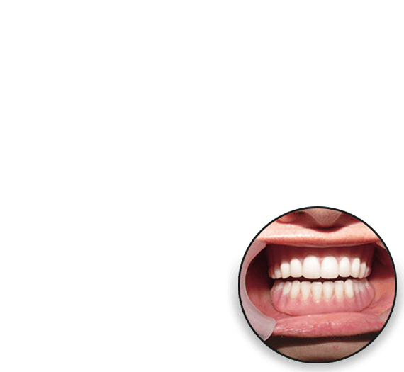 Layer