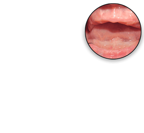 Layer