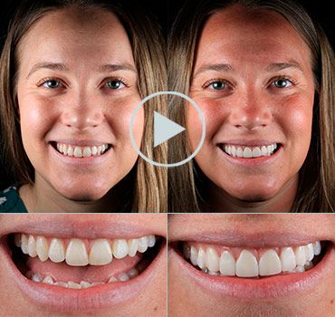 Reviews Smile Makeove Playa del Carmen