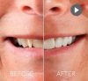 Dental solutions at Smile Makeover