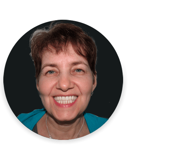 Dental Implants in Mexico