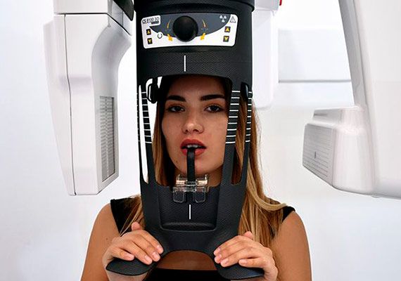 3D CBCT Panoramic X-Ray