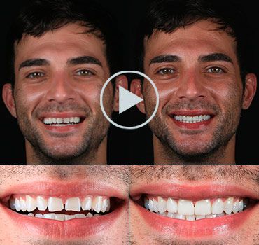 Smile Makeover Playa del Carmen reviews